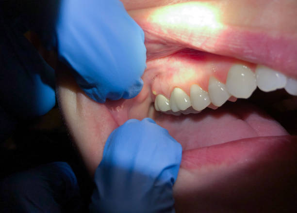 Best Cracked Tooth Emergency Dentist  in Hopkinsville, KY